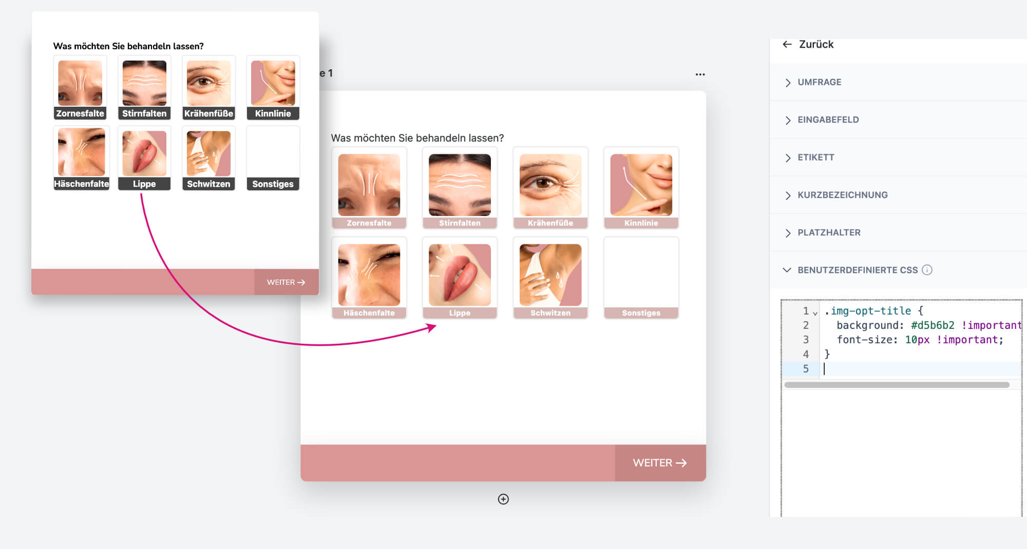 Das hochgeladene Bild zeigt eine Benutzeroberfläche einer medizinischen Umfrage zur Behandlung von ästhetischen Gesichtszonen. Auf der linken Seite sieht man ein Auswahlfeld, in dem der Benutzer zwischen verschiedenen Gesichtsbehandlungsoptionen wie „Zornesfalte“, „Lippe“ oder „Krähenfüße“ wählen kann. Der Designfluss wird durch einen pinken Pfeil verdeutlicht, der den Übergang zwischen den Schaltflächen markiert. Auf der rechten Seite des Bildes befindet sich ein Bereich mit benutzerdefiniertem CSS-Code, der für die Formatierung dieser Optionen verwendet wird. Dieses Bild illustriert perfekt, wie ein Digitaldesigner in Österreich mithilfe von ChatGPT CSS die Ästhetik einer Umfrage anpassen kann, indem er direkten Einfluss auf die Gestaltung der Benutzeroberfläche nimmt.